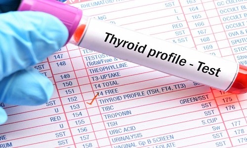 Thyroid Health Check