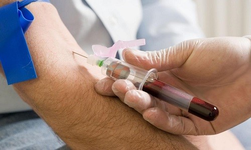 Hormone Blood Test For Men